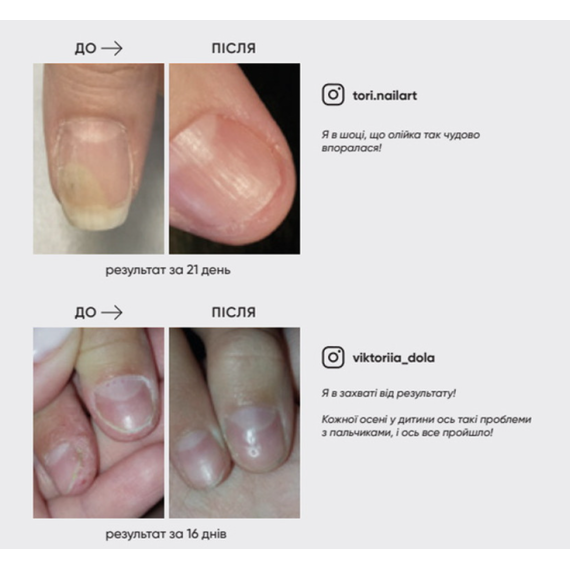 Масло от онихолизиса NAILSOFTHEDAY OniStop, 15 мл, изображение 2