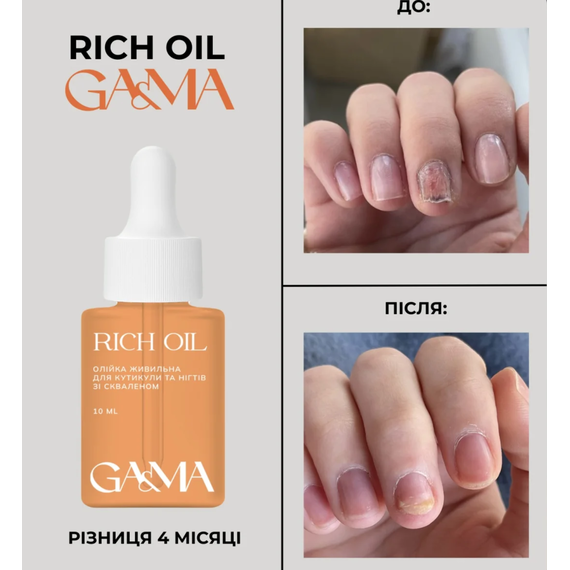 Олійка живильна GaMa Rich Oil зі скваленом для лікування нігтя, від оніхолізису, 2.5 мл, зображення 2