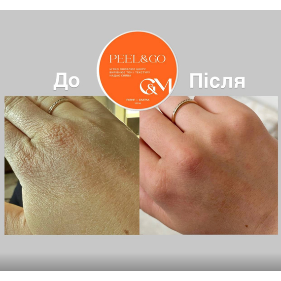 GaMa Peeling Peel hand peeling roller, 2 image